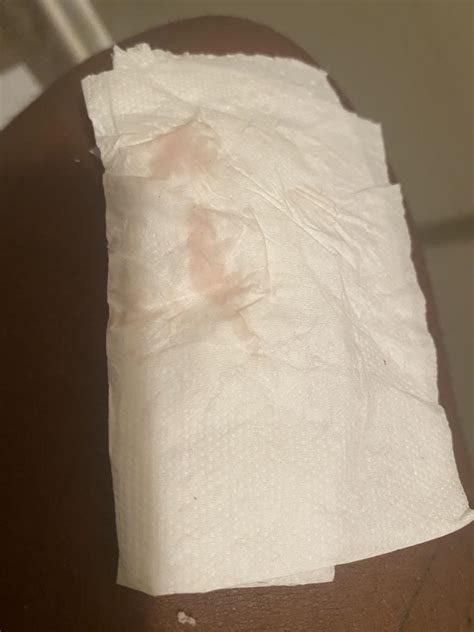 Is the implantation bleeding it’s not heavy or clots it’s only seen when I wipe : r/Trying2conceive