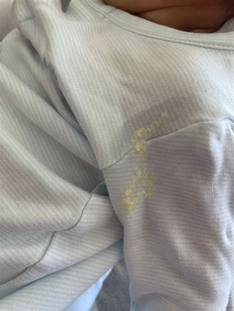 Yellow Baby Spit Up