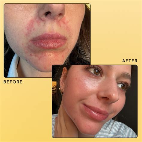 3% Sulfur Cleanser - Saving Face