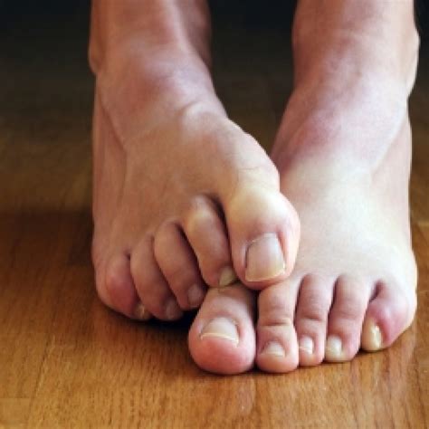 How To Cure Smelly Feet Home Remedies at Jasper Saranealis blog