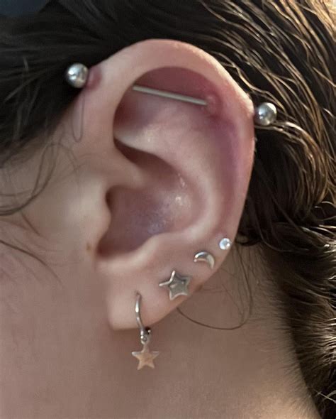Keloid Bump Navel Piercing at Arlene Ramirez blog