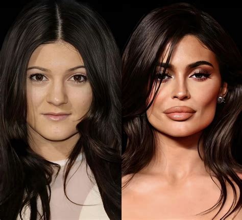 Pin by АНАСТАСИЯ on макияж | Celebrity plastic surgery, Celebrity surgery, Plastic surgery