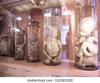 115 imágenes de Embryo museum - Imágenes, fotos y vectores de stock ...