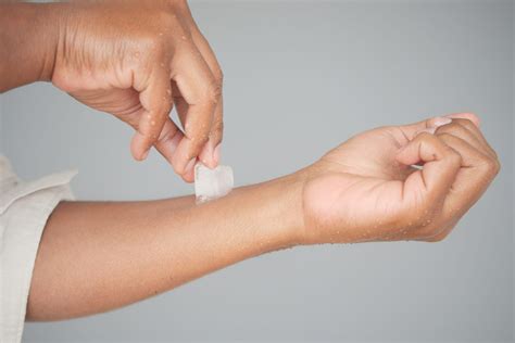 Why you can burn yourself with ice: what is cold burn