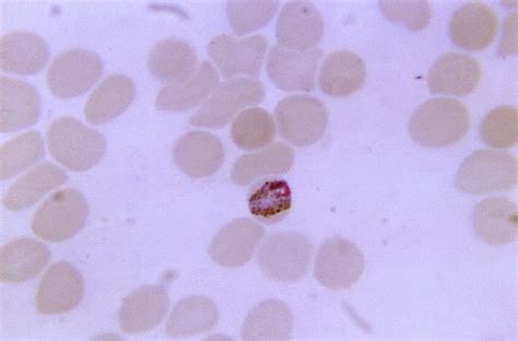 Free picture: thin, film, blood smear, micrograph, mature, band, form ...