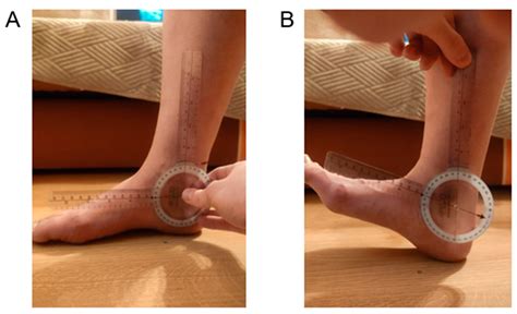 Symmetry | Free Full-Text | Does Mobility of the Ankle Joint Depends on ...
