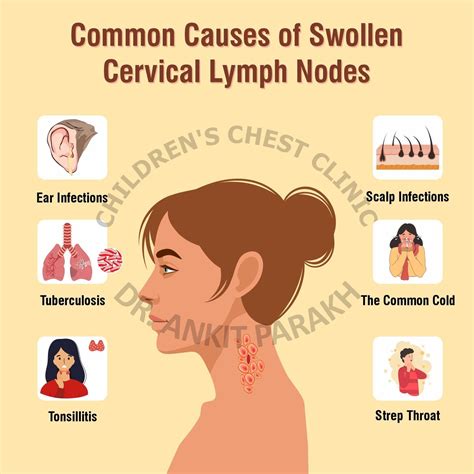 Swollen lymph nodes: symptoms, causes, and treatment, geschwollene ...