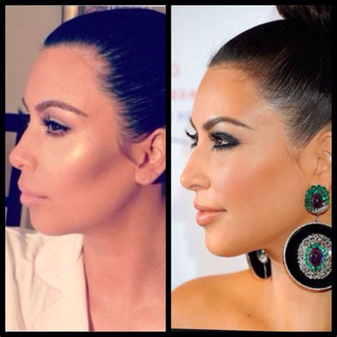 Kim Kardashian 2nd nose job plus lip injection & facial contouring with cheek filler Kardashian ...