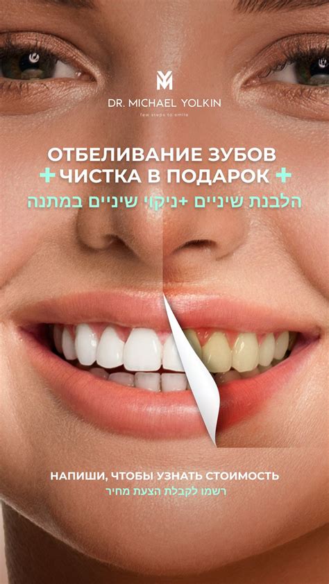 Макет для таргету Реклама стоматологія | Dental advertising, Dental ...