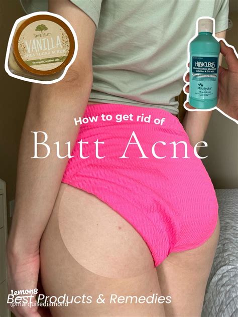 How to get rid of bumps on your butt? | 2024 real user experience on Lemon8