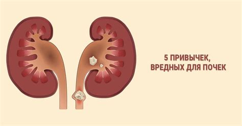Что полезно для почек: 20 продуктов, которые нужно пить и есть для ...