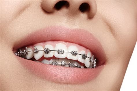 What Does an Orthodontist Do?