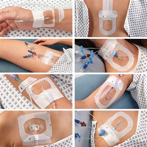 3M™ Tegaderm™ I.V. Advanced Securement Dressing, 1683, 6.5 cm x 7 cm ...