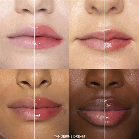 Lip Plumper Before And After Pictures at Anthony Bohnsack blog