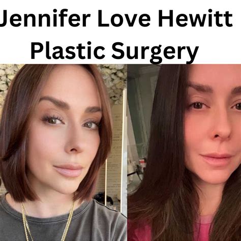 Jennifer Love Hewitt Face Surgery