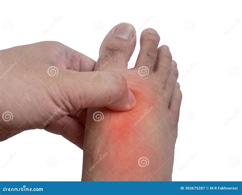 Pain In Foot Extensor Tendons at Charlie Oshanassy blog