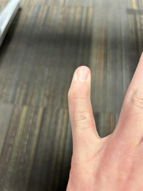 My pinky fingers are naturally crooked : r/mildlyinteresting