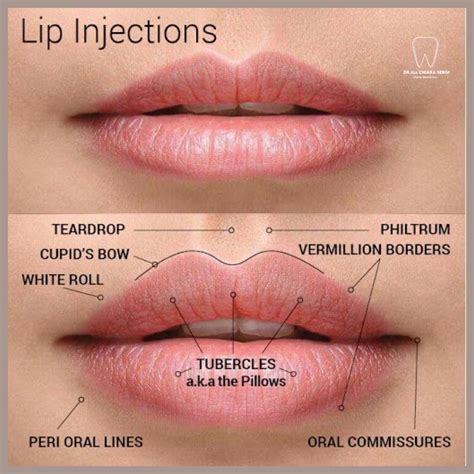 Fillers for lips before and after results from a qualified doctor – Artofit