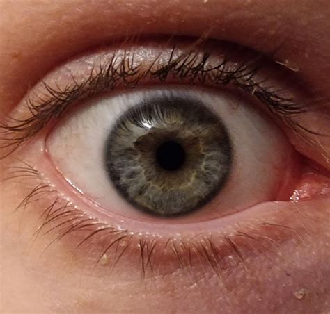 What color are my eyes? : r/eyes