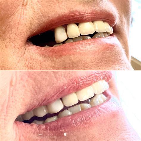 TK Dental Wayne | Dentists Wayne, NJ | Dr. Tatyana Kaminar, DDS