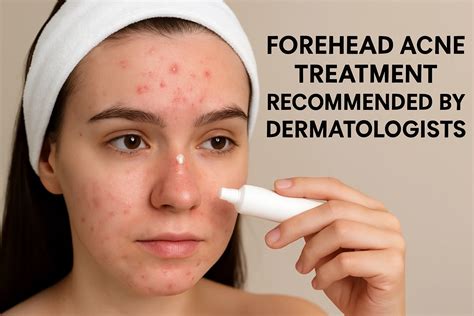 How to Treat Forehead Acne, Backed by Dermatologists
