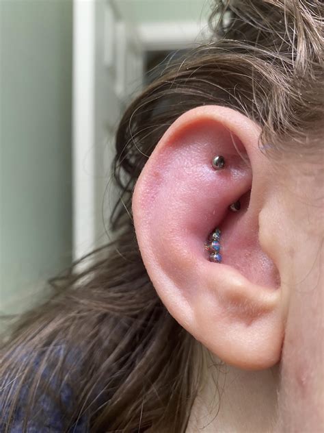 Infected Ear Piercing Causes And Treatments Ear
