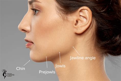 Jawline Filler Melbourne - Victorian Cosmetic Institute