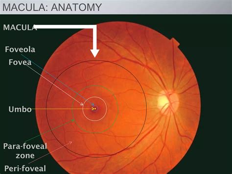 Age related macular degeneration | PPT