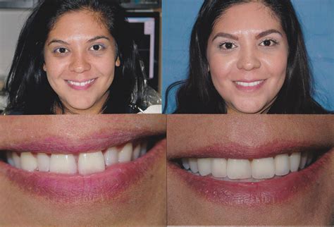 Dental Professionals Of Lincoln Park at Anna Beyers blog