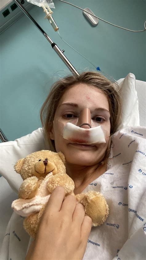 Day of operation- 1 day post op - 2 nd day post op. Is this swelling ...