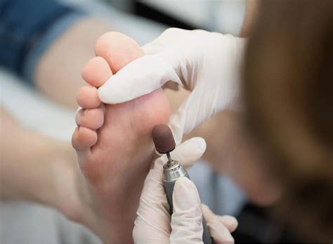 Non Cancerous Lesions Skin – Benign Growth on Skin | rtwskin