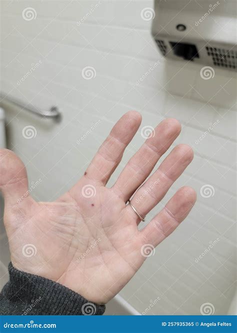 Bruised Palm Hand Under Hand Dryer Stock Image - Image of germs, fingers: 257935365