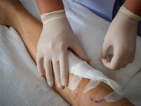 4 Types of Wound Drainage: Serous, Sanguineous & More