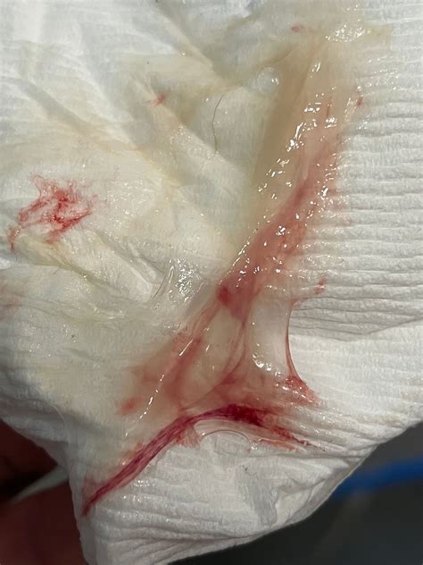 Membrane sweep 38 weeks 5 days | BabyCenter