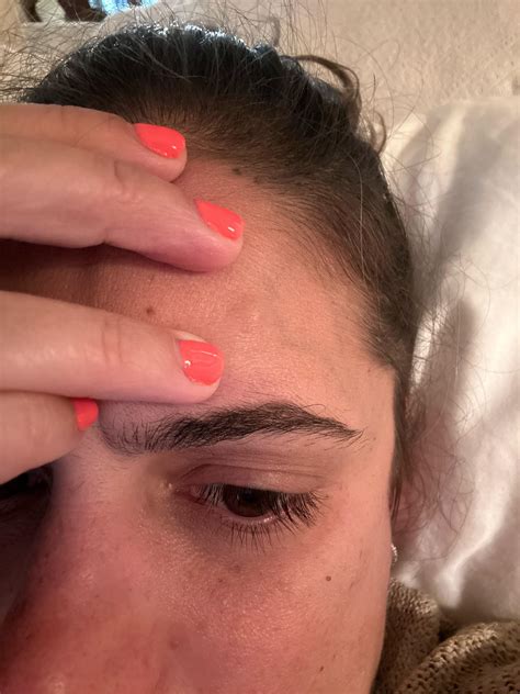 Small bump on forehead for about a month now. Feels firm… should I be concerned? What to do? : r ...