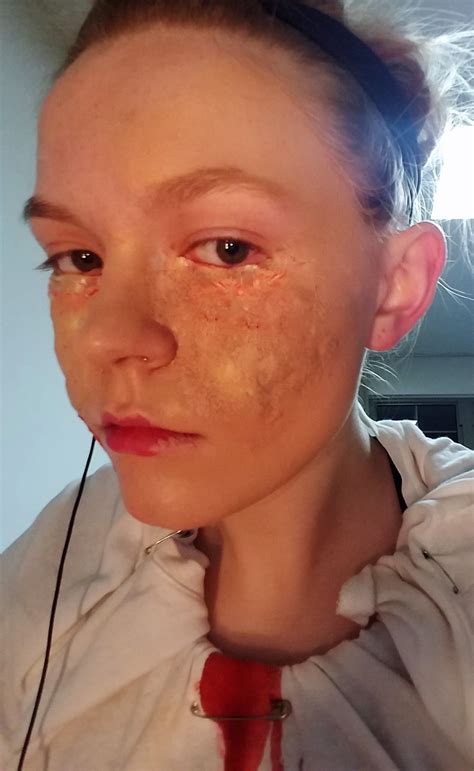 Child Eyes Gouged Out at Caitlin Gilles blog