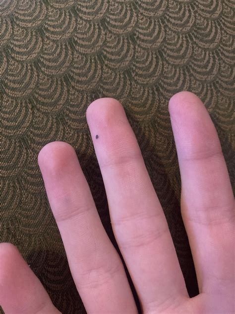 Mysterious black dot appeared on my middle finger around 2 weeks ago ...