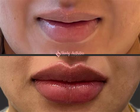 The Truth Behind The Smallest Lips In The World Guinness Record