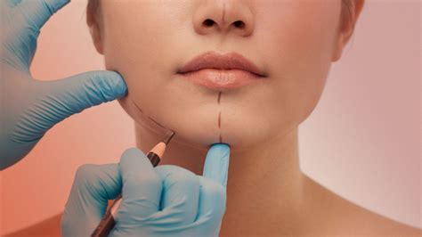 Experts Predict the Biggest Plastic Surgery Trends for 2023 | Allure