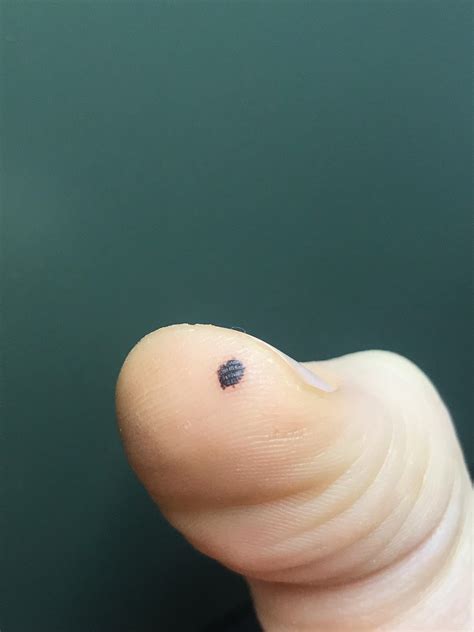 Black Patches Under Skin at Victor Adkins blog