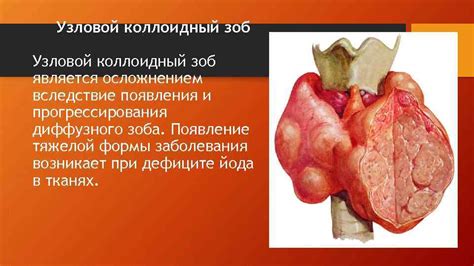 Запорожский государственный медицинский университет Кафедра ...