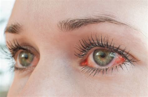Feeling Pressure in Your Eyes? Common Causes & Treatments