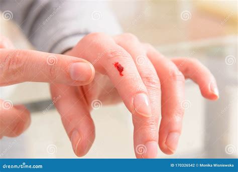 Blood From Finger at Lynn Potter blog