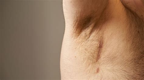 Ganglios Linfáticos Inflamados: Conoce Las Señales De Alerta – MLOX DEL