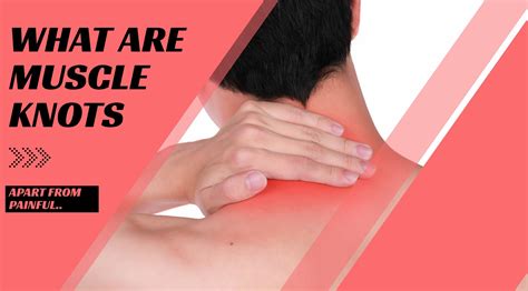 What Are Muscle Knots?