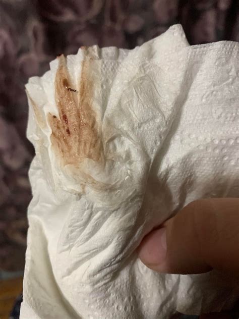 Brown Discharge Implantation Bleeding