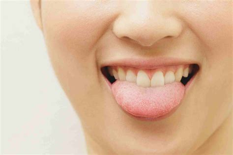 Bitter Taste In Mouth