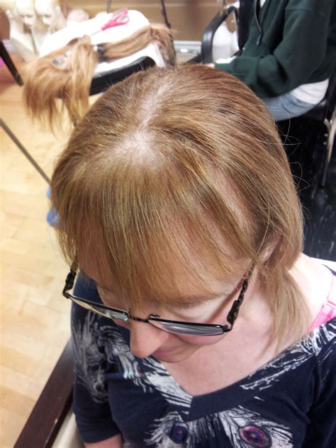 Hairstyles For Balding Crown Female - Fade Haircut Styles