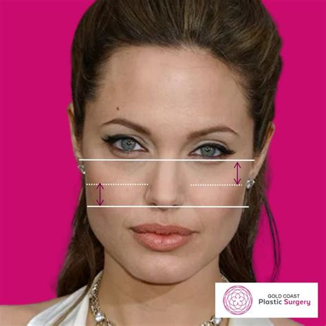 High vs Low Cheekbones: How do you know?