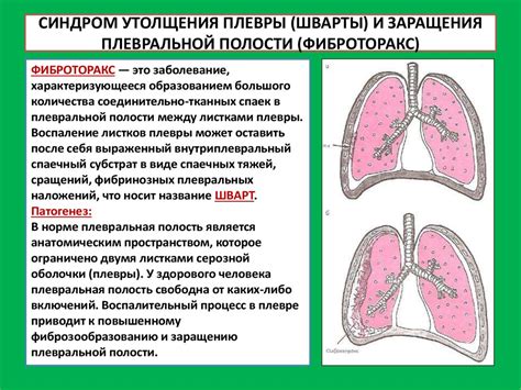 Анализ мокроты и плеврального выпота - презентация онлайн